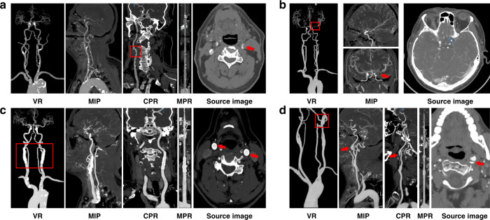 Fig. 6