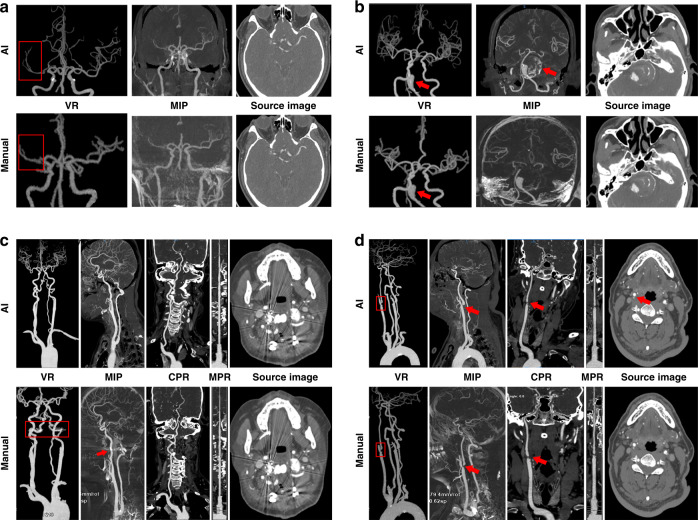 Fig. 4