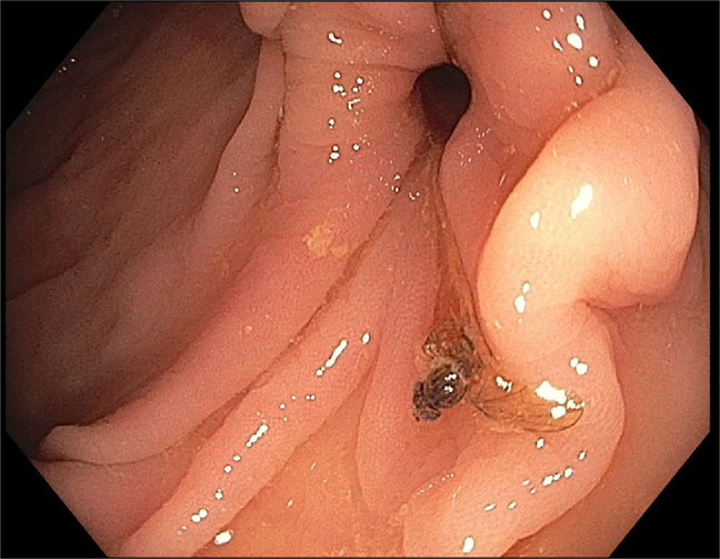 Figure 3.