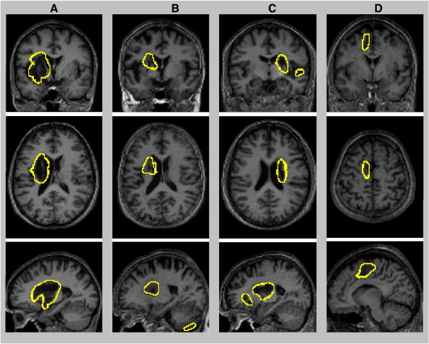 Fig. 9