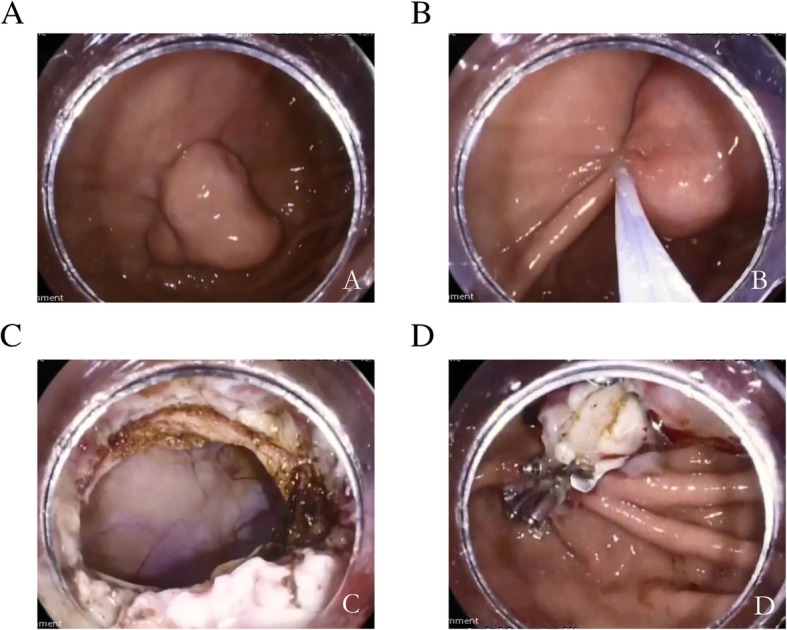 Fig. 2