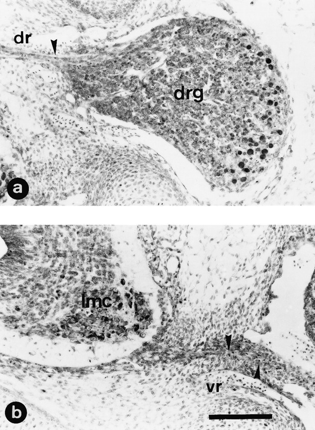 Fig. 12.