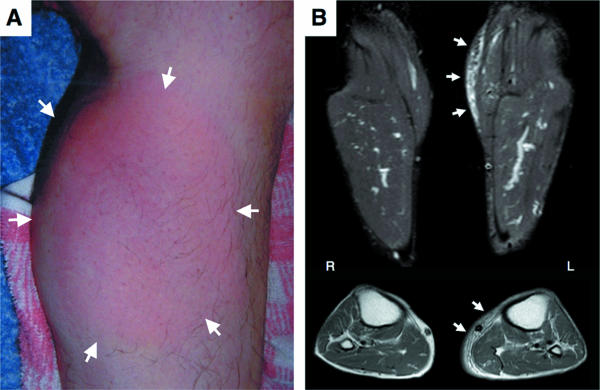 FIG. 1.