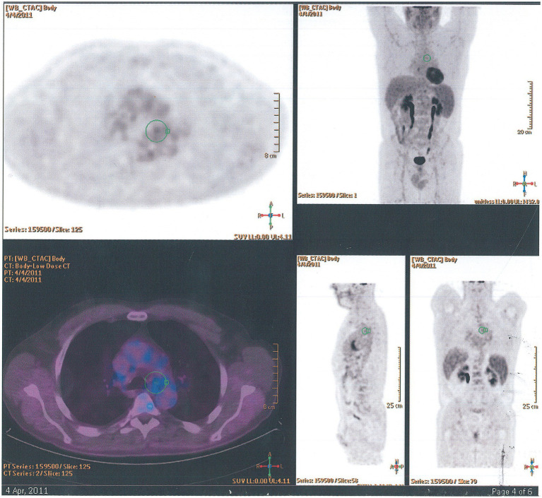 Figure 12