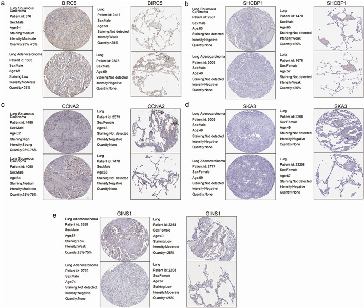 FIGURE 11