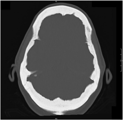 Fig. 1