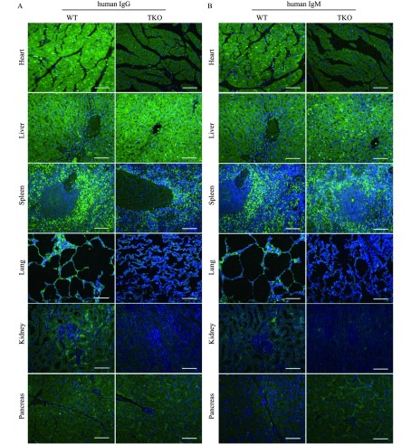 A–B: Human serum IgG and IgM binding assays revealed obviously greater binding to WT pig heart, spleen, lung, and kidney. Human serum bound less strongly to WT than TKO pig liver tissues, and there was no significant difference in the pancreas between WT and TKO pigs. Scale bar = 100 μm.