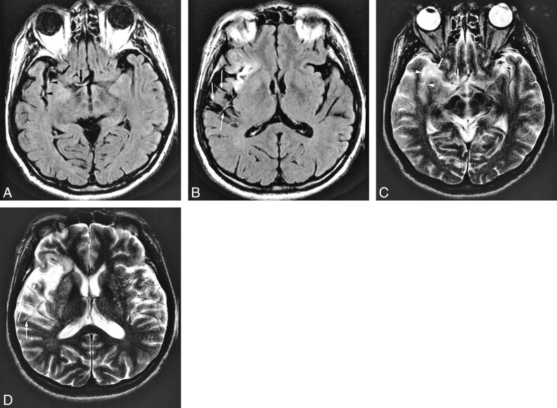 fig 5.