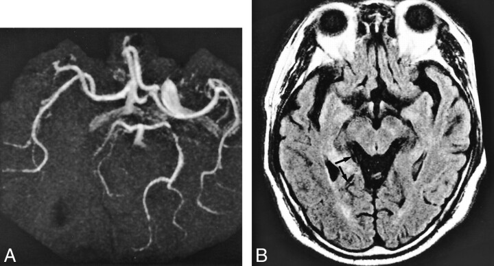 fig 3.