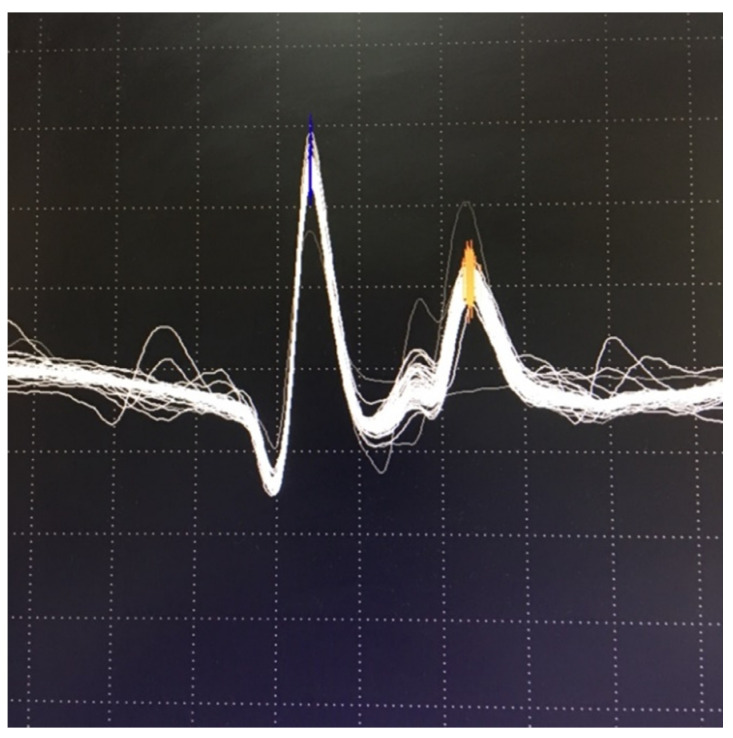Figure 7
