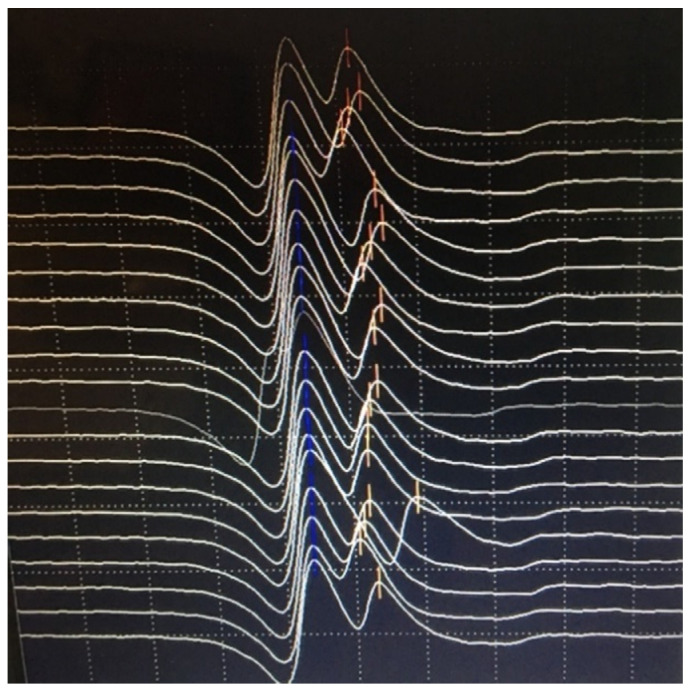Figure 10