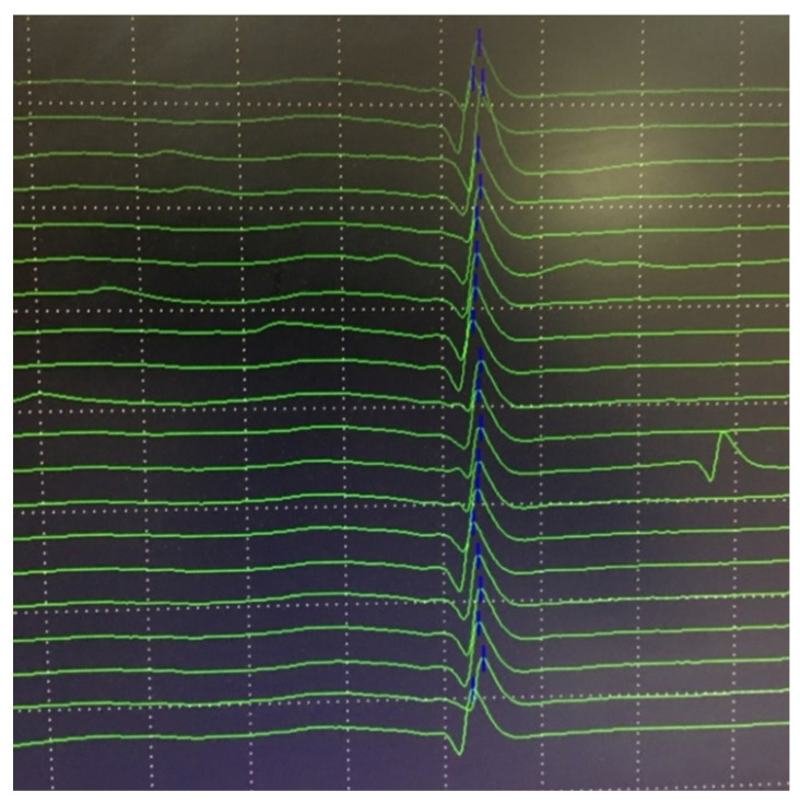 Figure 8
