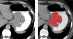 Figure 2. a, b