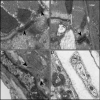 Figure 22