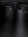 graphic file with name fx1_lrg.gif