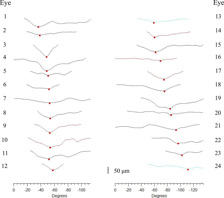 Figure 3: