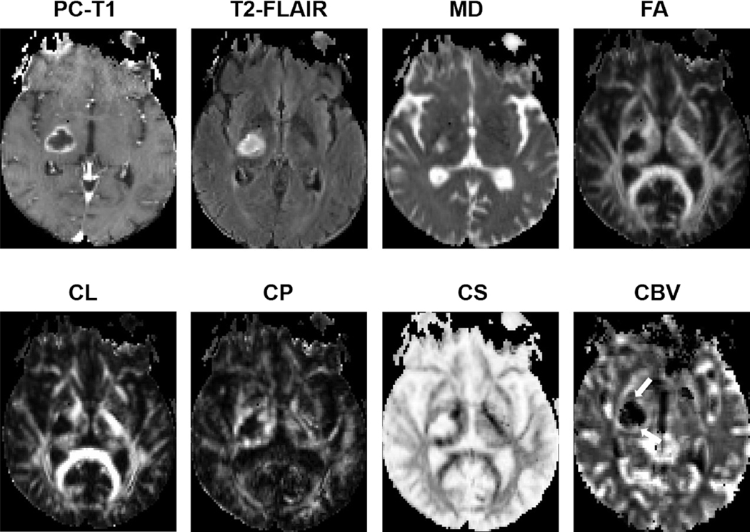 FIGURE 11: