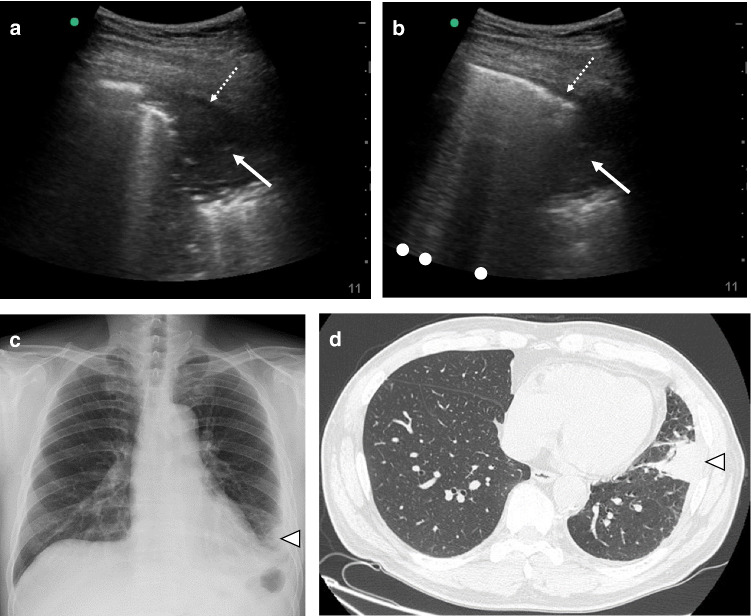 Fig. 4