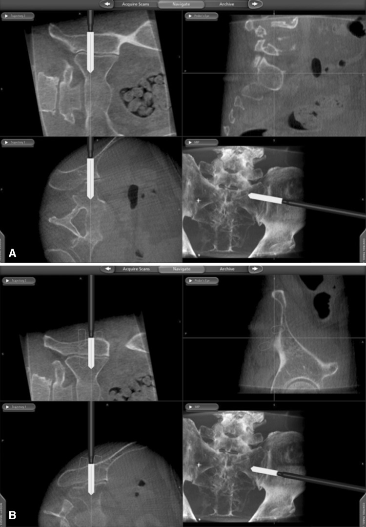 Fig. 2A–D