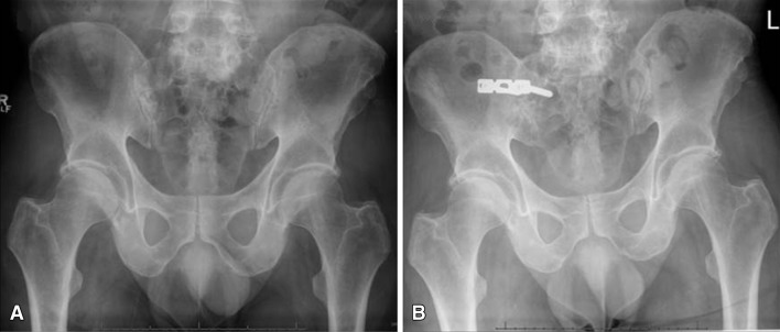 Fig. 1A–B