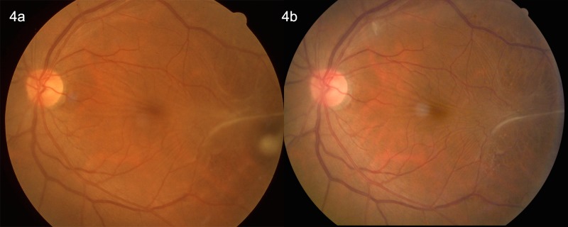 Fig 4