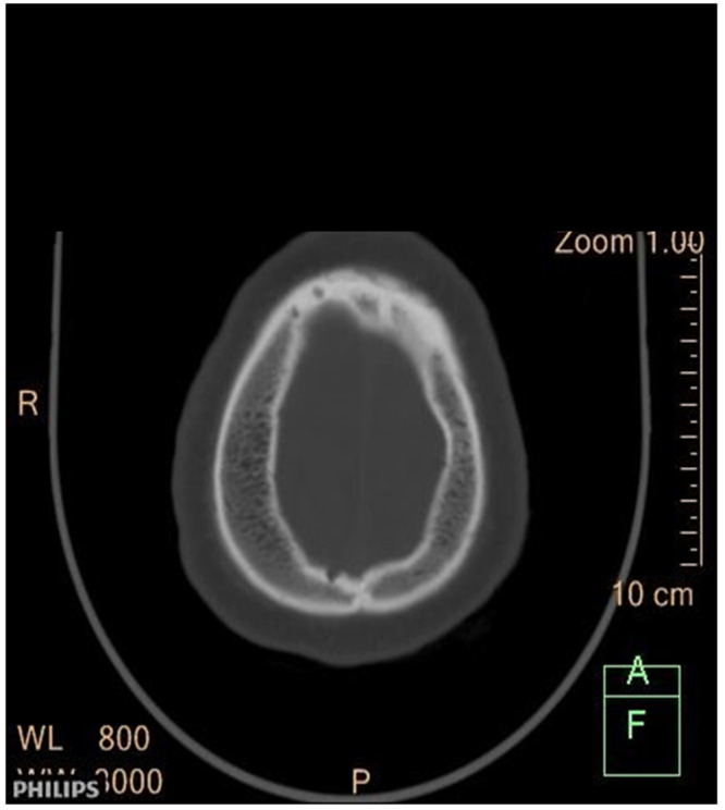 Figure 3. 
