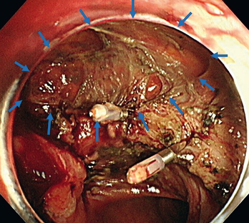 Fig. 2