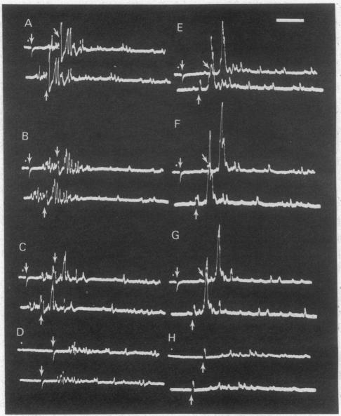 graphic file with name pnas00660-0641-a.jpg