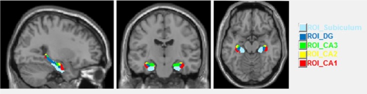 FIGURE 2