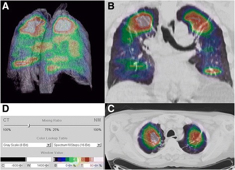 Fig. 2