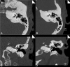 Fig 5.