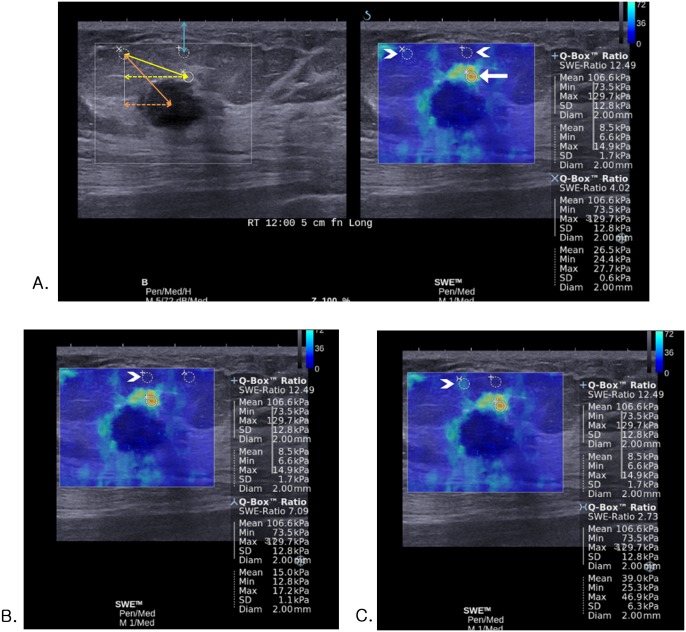 Fig 1