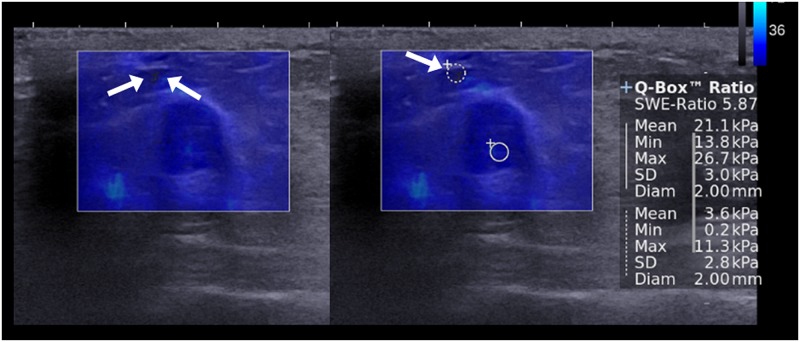 Fig 3