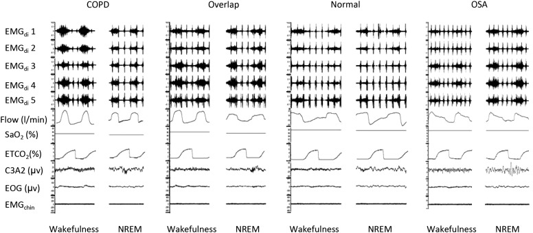 Figure 1