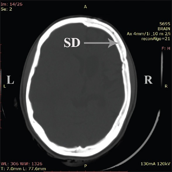 Figure 2