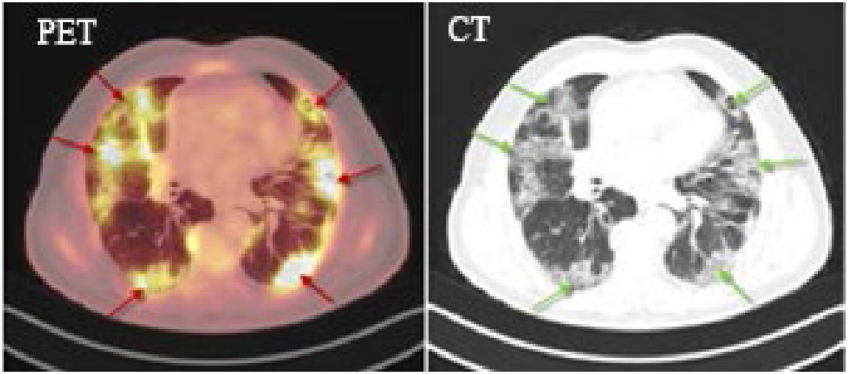 Fig. 13.