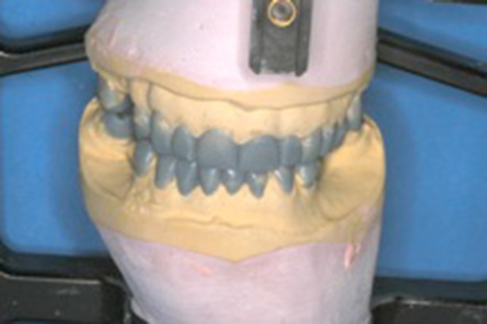 Fig. 3