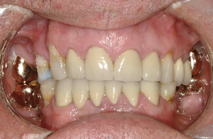 Fig. 9