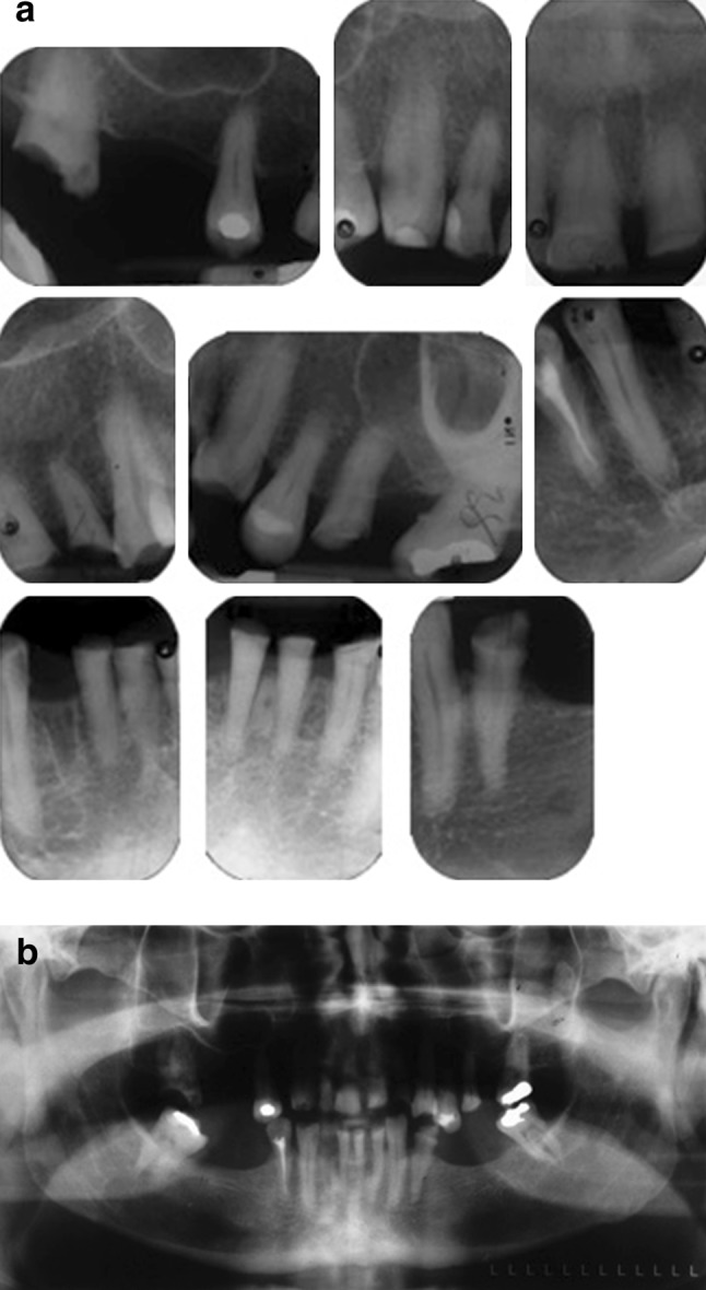 Fig. 2