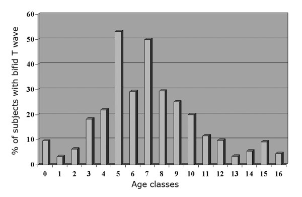 Bifid T waves in leads V2 and V3 in children: a normal variant - PMC