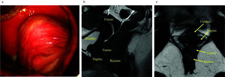 Fig. 1