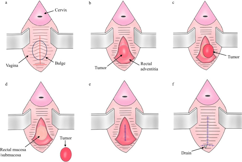 Fig.3