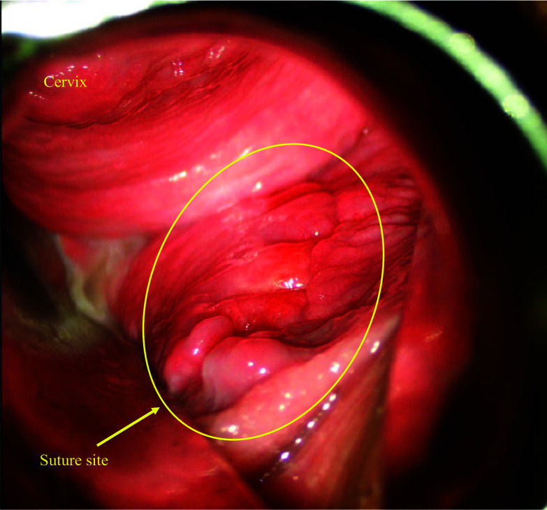 Fig. 4