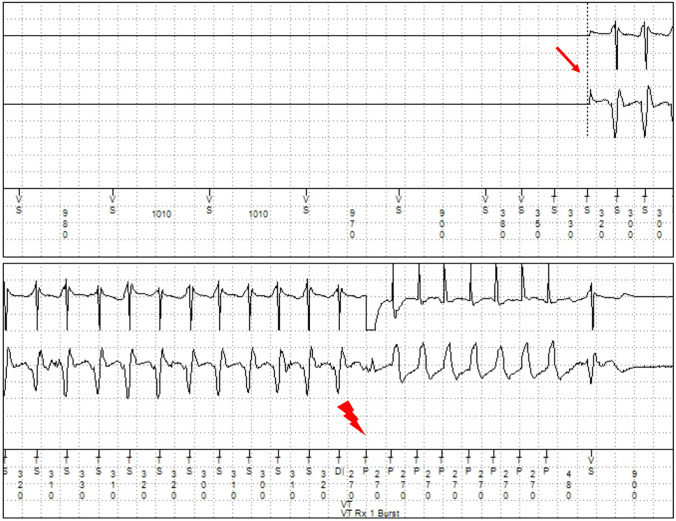 Fig. 3