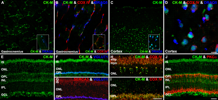 Figure 15