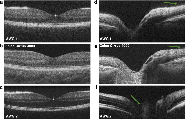 Fig. 5