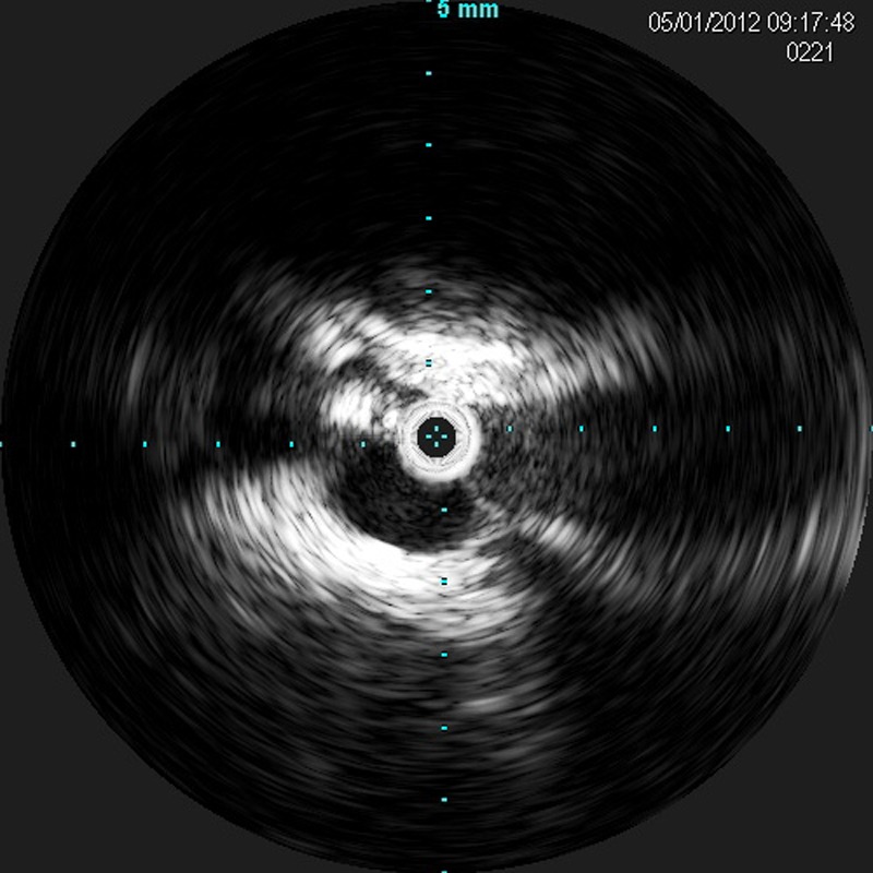 Figure 5