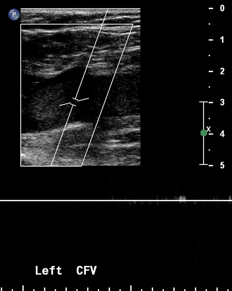 Figure 3