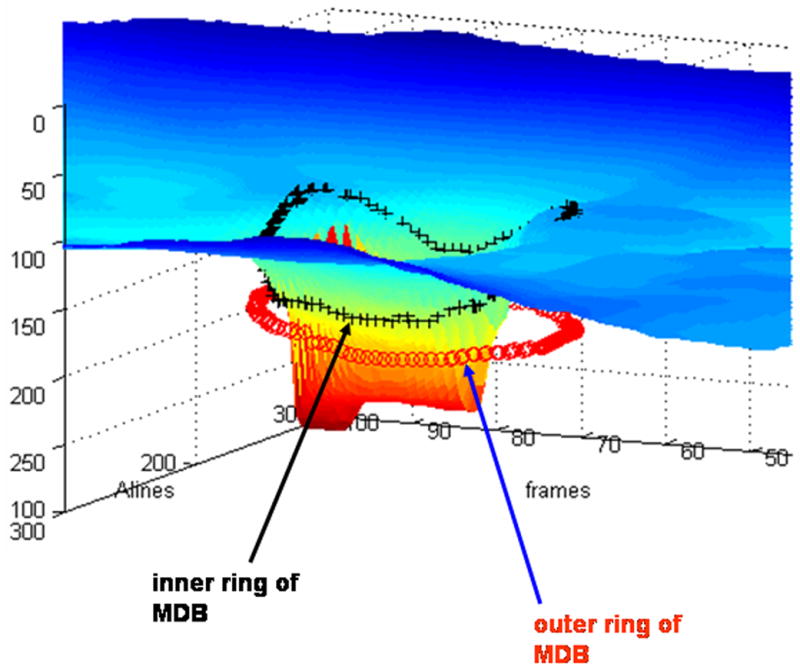 Figure 11