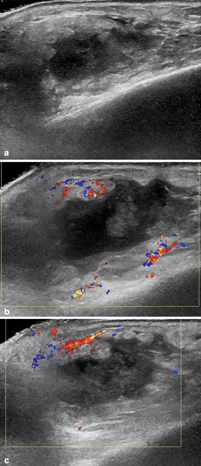 Fig. 1